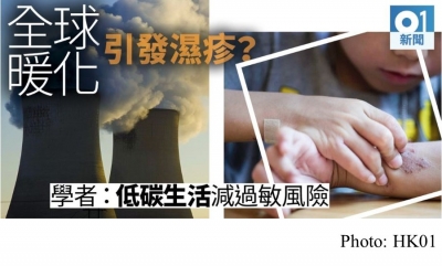 全球暖化與濕疹、哮喘有關？　醫學論文：減碳生活減患病風險 (HK01 - 20180619)